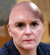 bald Burney