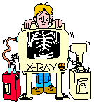 X-rayed Scouser